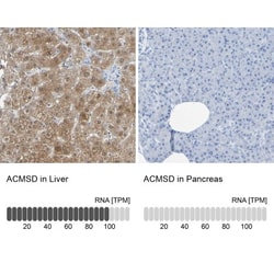 ACMSD Antibody, Novus Biologicals 0.1mL; Unlabeled:Antibodies, Polyclonal
